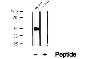 Image no. 1 for anti-Peptidase (Mitochondrial Processing) beta (PMPCB) (Internal Region) antibody (ABIN6264318)
