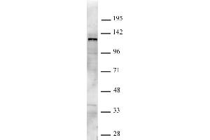 Image no. 1 for anti-Lysine (K)-Specific Demethylase 4C (KDM4C) antibody (ABIN6972228)