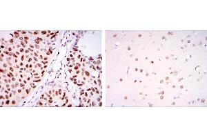 Image no. 4 for anti-PC4 and SFRS1 Interacting Protein 1 (PSIP1) antibody (ABIN969370)