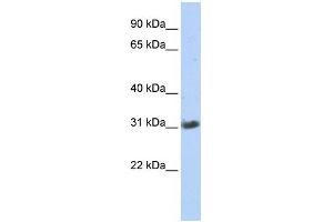 Image no. 1 for anti-Zinc Finger, AN1-Type Domain 3 (ZFAND3) (Middle Region) antibody (ABIN2781164)