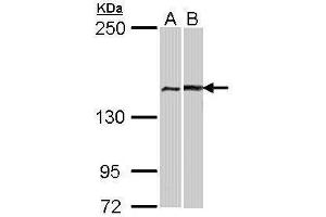 Image no. 2 for anti-Fanconi Anemia Group A Protein (FANCA) (N-Term) antibody (ABIN2856901)