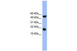 Image no. 1 for anti-RWD Domain Containing 1 (RWDD1) (AA 41-90) antibody (ABIN6746575)