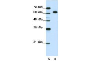 Image no. 2 for anti-DIS3-Like Exonuclease 2 (DIS3L2) (N-Term) antibody (ABIN630034)