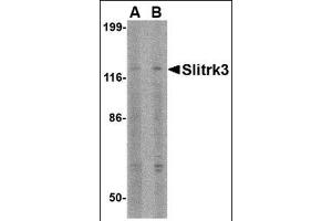 Image no. 1 for anti-SLIT and NTRK-Like Family, Member 3 (SLITRK3) (C-Term) antibody (ABIN500760)