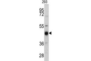 Image no. 3 for anti-Keratin 13 (KRT13) antibody (ABIN3002761)