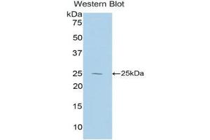 Image no. 1 for anti-Interleukin 27 (IL27) (AA 32-234) antibody (ABIN1859408)