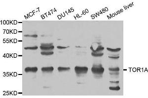 anti-Torsin Family 1, Member A (Torsin A) (TOR1A) antibody