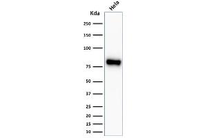 Image no. 1 for anti-Catenin (Cadherin-Associated Protein), beta 1, 88kDa (CTNNB1) antibody (ABIN6939211)
