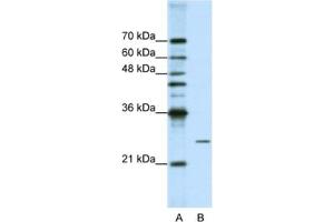 Image no. 1 for anti-Processing of Precursor 4, Ribonuclease P/MRP Subunit (POP4) antibody (ABIN2462223)