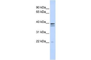 Image no. 1 for anti-Rab Geranylgeranyltransferase, beta Subunit (RABGGTB) antibody (ABIN2459215)