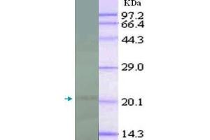 Image no. 1 for anti-Interleukin 18 (IL18) (full length) antibody (ABIN1854143)