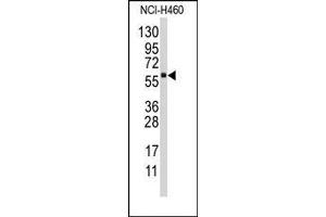 Image no. 1 for anti-Cytochrome P450, Family 4, Subfamily F, Polypeptide 12 (CYP4F12) (C-Term) antibody (ABIN360265)