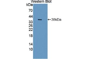Image no. 2 for anti-NIMA (Never in Mitosis Gene A)-Related Kinase 2 (NEK2) (AA 125-393) antibody (ABIN5014007)