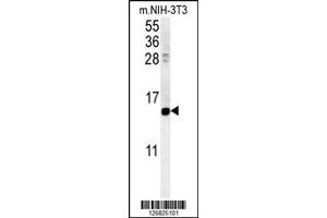 Western Blotting (WB) image for anti-Cellular Retinoic Acid Binding Protein 1 (CRABP1) antibody (ABIN2158359)