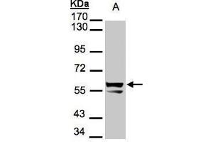 Image no. 3 for anti-Keratin 6A (KRT6A) (Center) antibody (ABIN2856088)