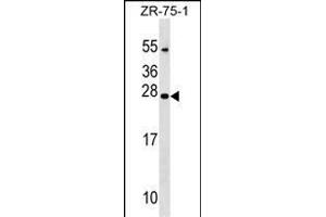 NXNL1 Antibody (Center) (ABIN1538700 and ABIN2849312) western blot analysis in ZR-75-1 cell line lysates (35 μg/lane).