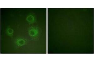 Immunofluorescence analysis of HuvEc cells, using NMDAR2A/B (Phospho-Tyr1246/1252) Antibody.