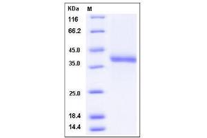 Image no. 1 for Chemokine (C-X-C Motif) Ligand 12 (CXCL12) (AA 1-89) (Active) protein (Fc Tag) (ABIN2009688)