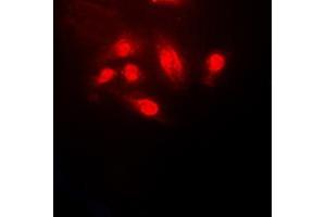 Image no. 1 for anti-Cofilin 1 (CFL1) (N-Term) antibody (ABIN2707432)