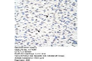 Image no. 2 for anti-Small Nuclear Ribonucleoprotein Polypeptide F (SNRPF) (N-Term) antibody (ABIN2778834)