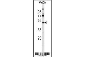 Image no. 1 for anti-Suppressor of Ty 7 Like (SUPT7L) (AA 186-214) antibody (ABIN1537989)