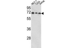 Image no. 1 for anti-Abl-Interactor 1 (ABI1) antibody (ABIN3003792)