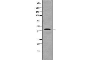 Image no. 1 for anti-Zinc Finger, DHHC-Type Containing 18 (ZDHHC18) (N-Term) antibody (ABIN6266094)