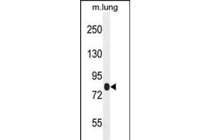 TTC30B 抗体  (C-Term)
