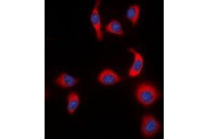 Image no. 2 for anti-Nuclear Factor of kappa Light Polypeptide Gene Enhancer in B-Cells Inhibitor, epsilon (NFKBIE) (pSer22) antibody (ABIN2957634)
