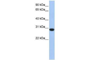 Image no. 1 for anti-Ankyrin Repeat and SOCS Box-Containing 12 (ASB12) (C-Term) antibody (ABIN634414)