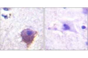 Image no. 1 for anti-Microtubule-Associated Protein 4 (MAP4) (AA 662-711) antibody (ABIN1532711)
