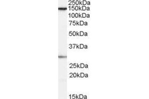 Image no. 1 for anti-Structure Specific Recognition Protein 1 (SSRP1) (Internal Region) antibody (ABIN2562522)