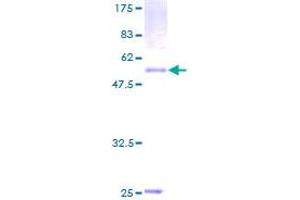 Image no. 1 for Phosphatidic Acid Phosphatase Type 2B (PPAP2B) (AA 1-311) protein (GST tag) (ABIN1315822)