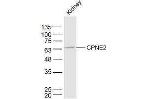 Copine II antibody  (AA 81-180)