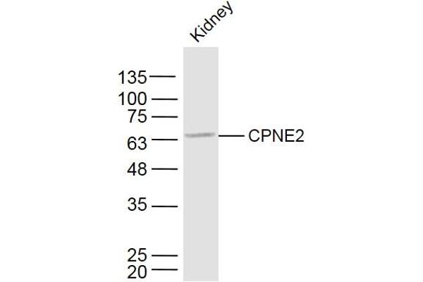 Copine II antibody  (AA 81-180)