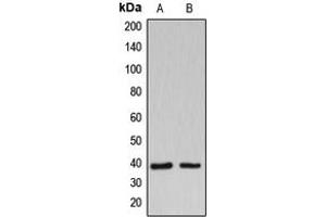 Image no. 1 for anti-UDP-Gal:betaGlcNAc beta 1,3-Galactosyltransferase, Polypeptide 1 (B3GALT1) (Center) antibody (ABIN2705554)