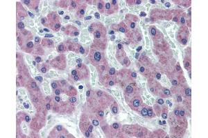 SLC27A2 antibody  (N-Term)