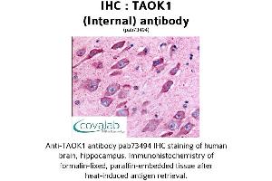 Image no. 1 for anti-TAO Kinase 1 (TAOK1) (Internal Region) antibody (ABIN1739899)