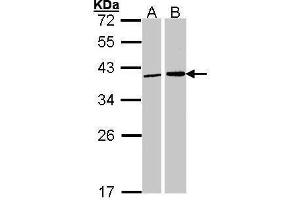 Image no. 2 for anti-Fibrillarin (FBL) (Center) antibody (ABIN2855179)