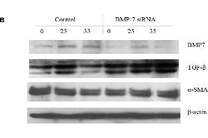Image no. 11 for anti-Actin, alpha 2, Smooth Muscle, Aorta (ACTA2) (N-Term) antibody (ABIN2857027)