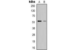 Image no. 1 for anti-Radical S-Adenosyl Methionine Domain Containing 1 (RSAD1) antibody (ABIN2801327)