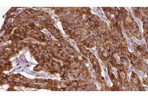 Image no. 1 for anti-Lymphocyte Cytosolic Protein 1 (LCP1) (pTyr28) antibody (ABIN6255870)