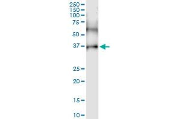 CD200R1 anticorps  (AA 1-348)