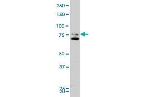 Image no. 1 for anti-Smoothened Homolog (Drosophila) (SMO) (AA 653-787) antibody (ABIN520309)