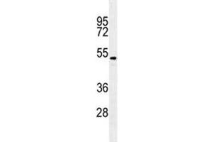 Image no. 6 for anti-Transforming Growth Factor, beta 2 (TGFB2) antibody (ABIN3029221)