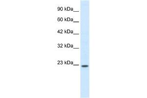 Image no. 1 for anti-Homeobox B6 (HOXB6) (N-Term) antibody (ABIN2777270)