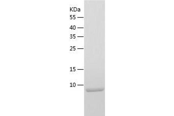 S100A14 Protein (AA 1-104) (His tag)