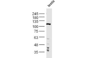 Image no. 3 for anti-Protein Phosphatase 1, Regulatory (Inhibitor) Subunit 10 (PPP1R10) (AA 151-250) antibody (ABIN1386277)