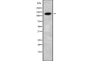 Image no. 1 for anti-Cation Channel, Sperm-Associated, beta (CATSPERB) antibody (ABIN6260507)