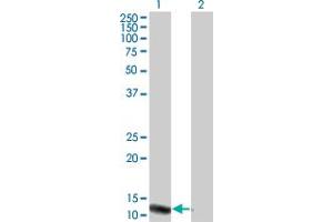 anti-Pre-B Lymphocyte 3 (VPREB3) (AA 24-123) antibody